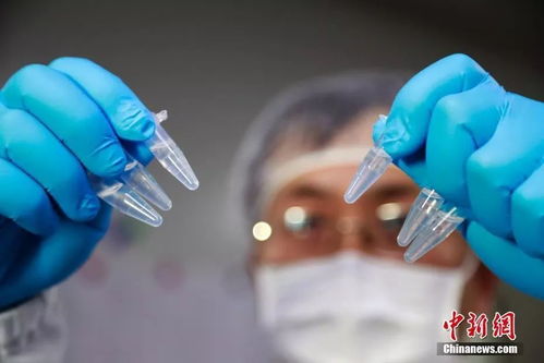 顯微鏡下的新型冠狀病毒 驚人繁衍與生物技術(shù)應對